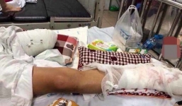 Thêm tình tiết kinh hoàng vụ thanh niên bị truy sát chém nát chân