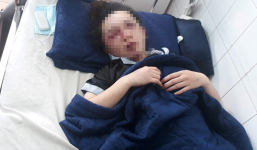 Nữ nhân viên spa bị nhóm côn đồ bắt cóc, đưa lên taxi đánh dã man