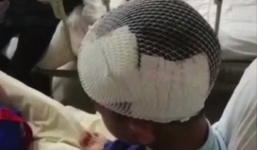 Mẹ kế tương lai tàn nhẫn dùng búa đập đầu con riêng của chồng