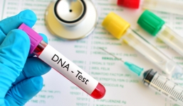 Tìm cha cho con, cô gái dẫn 5 người đàn ông đi xét nghiệm ADN