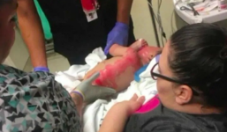 Hình ảnh đáng thương của bé gái này sẽ khiến các mẹ không bao giờ dám để con trong xe tập đi