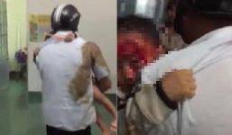 Vụ cha ôm con máu chảy đầm đìa chạy khắp bệnh viện tìm bác sĩ, Sở Y tế Đắk Lắk nói gì?