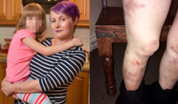 Chỉ bằng một câu nói, cô bé 6 tuổi bất ngờ cứu mẹ thoát khỏi địa ngục trần gian suốt 3 năm trời