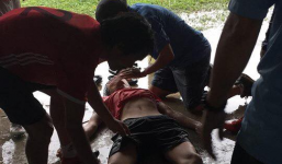 Đá bóng dưới trời mưa, nam thanh niên bị sét đánh nguy kịch