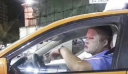 Đăng tải hình ảnh đắp mặt nạ dưỡng da khi đang lái xe, tài xế bị đình chỉ việc