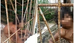 Người phụ nữ tâm thần bị gia đình lột quần áo, nhốt vào lồng sắt 15 năm