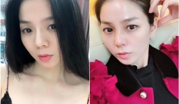 Lệ Quyên và chiếc mũi biến hình khó nhận ra