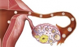 Báo động từ cái chết của hot girl 25 tuổi bị ung thư: Những dấu hiệu ai cũng cần nhớ