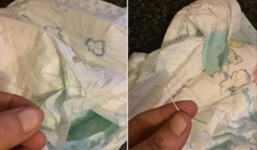Mẹ hốt hoảng khi tìm thấy kim khâu trong tã quần của con trai