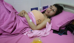 Chuyên gia thẩm mỹ: Túi nâng ngực không thể bị nổ trên máy bay