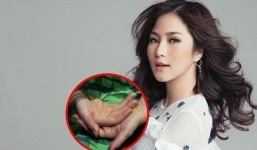 Hương Tràm liên tục mất ngủ, stress đến mức tự bóc tay rỉ máu khiến người hâm mộ lo lắng