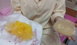 Thực hư túi độn ngực bị vỡ do áp suất trên máy bay