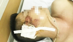 Vợ tài xế taxi sợ hãi kể lại giây phút chồng bị người ngồi trong xe Mazda bắn