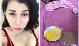 Hậu nổ vòng 1, 'thánh nữ: Bolero vẫn cố chi 100 triệu đồng bơm ngực