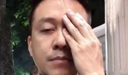 Clip: Tuấn Hưng tiết lộ thị lực giảm nặng, không thể nhìn rõ mọi thứ vì tai nạn trên sân cỏ