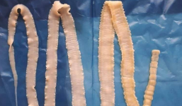 Phát hiện ổ sán dây lợn, ít nhất 108 người ở Bình Phước mắc bệnh