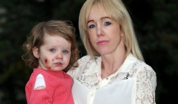 Vừa rời mắt 1 giây, mẹ quay lại đã thấy con bị cắn 15 vết sâu hoắm khắp người, thủ phạm đứng nhìn với nụ cười đầy máu