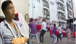 Vụ chặt tay tài xế ô tô: Nạn nhân bị đứt động mạch, máu phun không ngừng khi vào bệnh viện