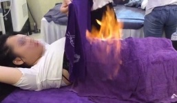 Sự thật về phương pháp đốt cồn 'rán mỡ' được các spa quảng cáo giảm 5 - 6kg mỡ/tháng