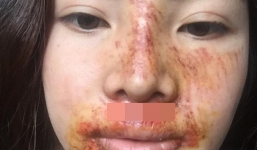 Sự thật về tin đồn hot girl thẩm mỹ Phượng 'Thị Nở' bị biến chứng sau thẩm mỹ khiến mặt mũi biến dạng?