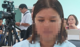 Hy hữu: Bệnh nhân đứng trước nhà bị đạn bay lọt vào mắt