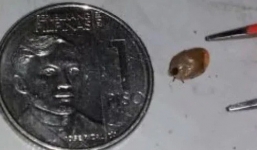 Con trai hét lên nhờ bố lấy con nhện ra khỏi tai nhưng thứ ở trong tai con khiến người cha kinh ngạc