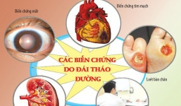 Căn bệnh cứ 6 giây lại khiến 1 người tử vong: Trả lời 7 câu hỏi sau xem mình có mắc bệnh