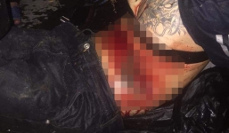 Hà Nội: Tên trộm nhảy xuống ao bỏ trốn, bị vật nhọn đâm thủng bụng