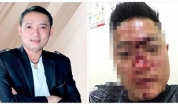 Khán giả bị đánh thương nặng vì quấy rồi Chiến Thắng trên sân khấu