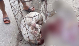 Chó Pitbull nặng 30kg điên cuồng lao vào cắn nữ chủ nhà và hàng xóm nhập viện