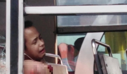 Thanh niên đau đớn mất cánh tay chỉ vì thói quen mà rất nhiều người mắc phải khi đi xe buýt