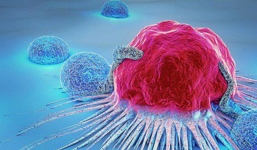 Dấu hiệu cảnh báo sớm 13 bệnh ung thư: Dù chỉ có 1 dấu hiệu cũng nên khám ngay