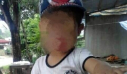 Bé trai 5 tuổi tử vong bất thường sau khi nhập viện