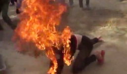 Cô gái 15 tuổi đổ dầu lên người mẹ rồi châm lửa đốt vì bị so sánh với em trai