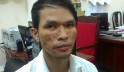 Kẻ hành hạ dã man em bé Campuchia được tại ngoại do mắc bệnh nan y