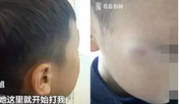 Cậu bé 7 tuổi bị cô giáo đánh vì sờ ngực, trong khi bố mẹ phẫn nộ thì phản ứng của cư dân mạng khiến ai cũng bất ngờ