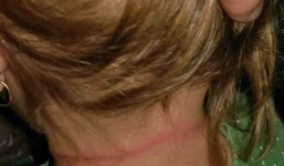 Tỉnh giấc thấy mái tóc mình bị mắc kẹt, nhìn về hướng con, mẹ hoàn toàn sốc trước những gì đập vào mắt