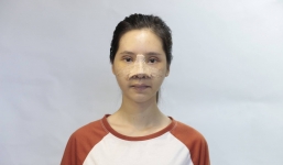 'Mặt xấu xí như vậy chỉ đem lại vận xui' - lời từ chối khi xin việc và màn 'lột xác' ngoạn mục của cô gái trẻ khiến bao người ngỡ ngàng