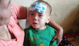 Bé gái 15 tháng tuổi sốt cao bị bỏ rơi trong bụi rậm ven đường