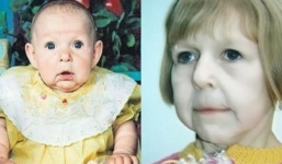 Chào đời với gương mặt già nua bị bố ruột chối bỏ, cô gái tự tạo nên kỳ tích cho đời mình, đánh bại mọi chẩn đoán y khoa