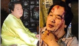 Trước khi gặp tai nạn nghiêm trọng, Hoàng Mập nhiều lần nằm mơ điều đáng sợ