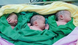  Cả thai kỳ mẹ Việt đi siêu âm thai đôi, đến khi mổ lấy ra 2 bé, bác sĩ phát hiện: 'Ôi trời đất ơi, còn 1 bé nữa!'