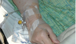 Bệnh nhân bị điều trị oan ung thư hiếm gặp, sau 5 năm mới phát hiện bác sĩ nhầm