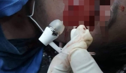 Vừa sạc điện thoại, vừa nghe nhạc nam thanh niên tử vong thương tâm