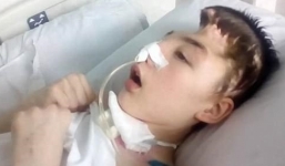 Chống trả tên hàng xóm cưỡng hiếp mẹ, cậu học sinh bị đánh mất nửa hộp sọ, mẹ đau đớn không dám đến thăm con