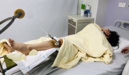 Truy tìm ô tô Range Rover vượt đèn đỏ, đâm nữ sinh chấn thương sọ não rồi bỏ trốn ở Hà Nội: