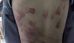 Cô giáo bàng hoàng khi trẻ nói bị sư trụ trì lấy xô đập vào đầu, ngâm dưới ao giữa mùa đông