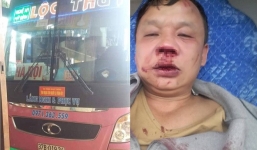 Tài xế xe khách cầu cứu vì bị nhóm côn đồ chặn đánh liên tục