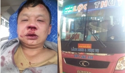 Vụ tài xế xe khách bị côn đồ chặn đánh: Chủ xe hé lộ có điện thoại tố lái xe trêu ghẹo vợ người