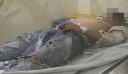 Cặp đôi bất động trên ghế đá ở ĐH Quốc gia TP HCM: Cô gái đã tử vong